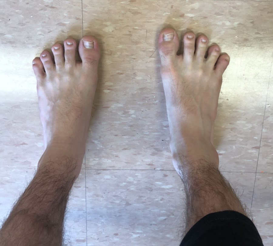 feet